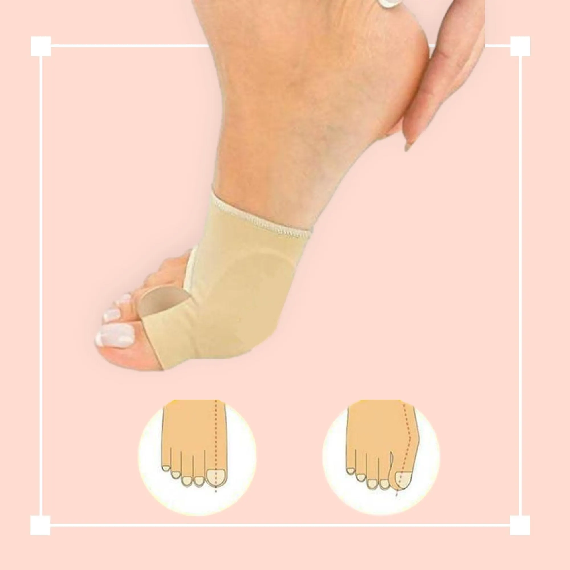 Orthopedic Toe Bunion Corrector